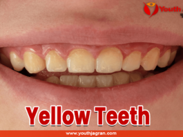 Yellow-Teeth