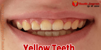 Yellow-Teeth